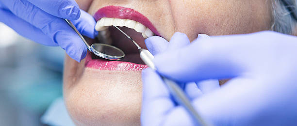 Best Emergency Dental Care for Abscessed Tooth in The Hammocks, FL
